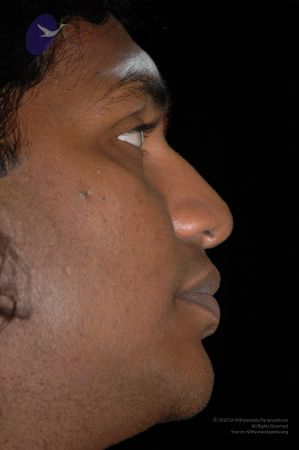 20060923 Photo 1799 1k-XPrdB1iqUNAzrZ-1TK2lDf4hBEIjfm.JPG